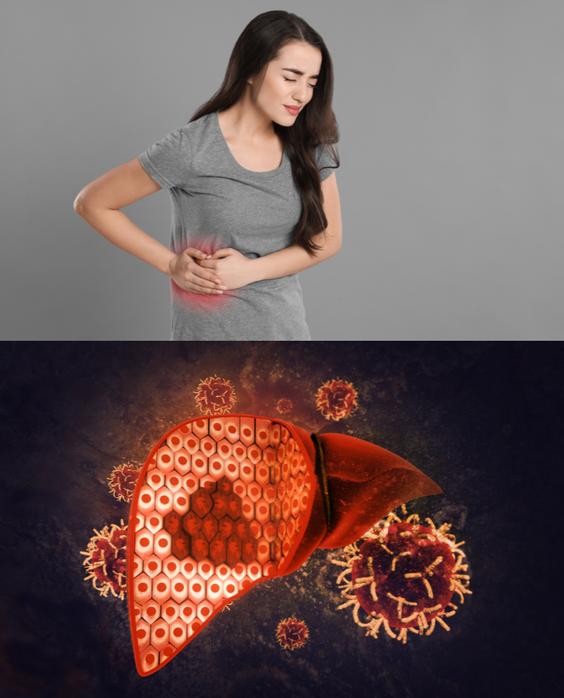 간암 증상과 간암 이미지