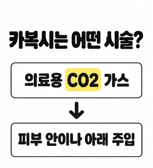의료용 이산화탄소 가스를 피부 안이나 아래에 주입하는 카복시 시술의 개념을 화살표로 연결한 이미지