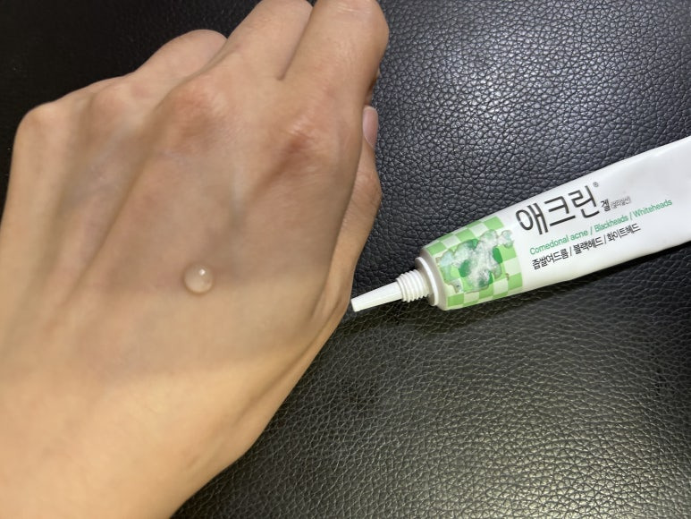 애크린 겔의 모습 관련사진