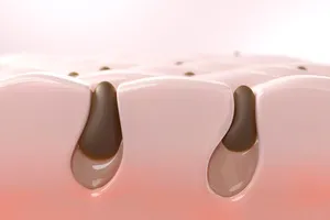 블랙-헤드-제거-방법