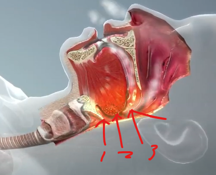 코골이가 발생하는 혀뿌리(1), 편도(2), 입천장(3)의 근육이 늘어지는 중간단계 모습