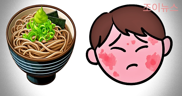 메밀 식품알레르기 증상