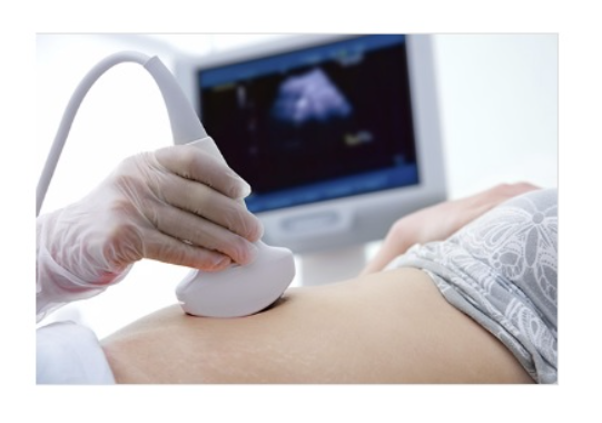 리노공업-주가-전망-배당금-알아보기