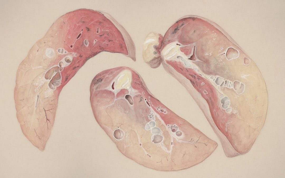 Arrhythmia