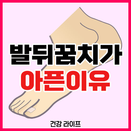 발뒤꿈치가 아픈이유