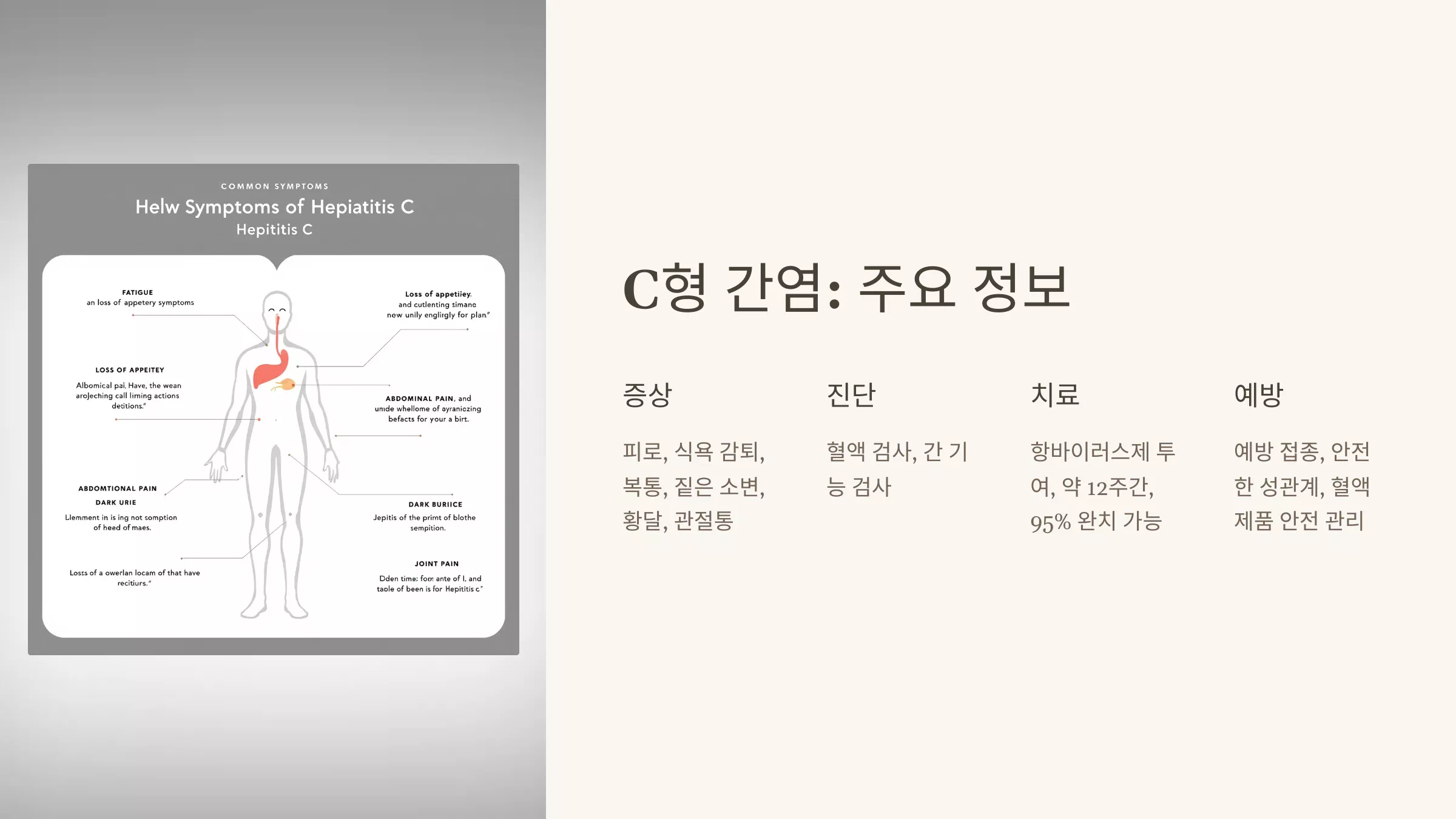 C형 간염 증상과 치료