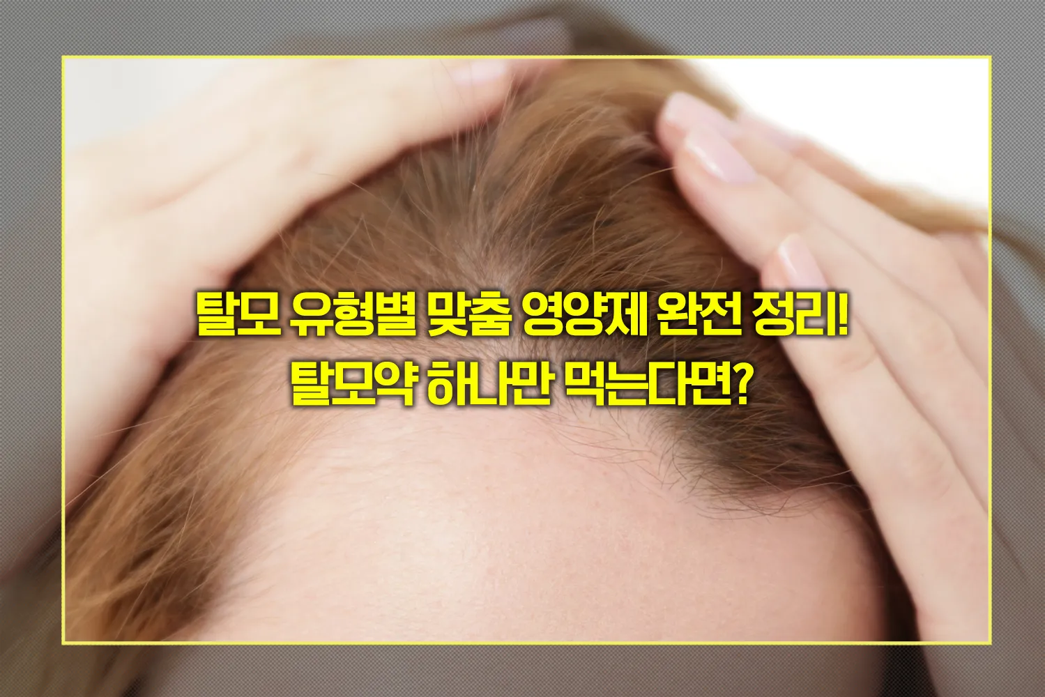 탈모-영양제-비오틴만으로-충분할까