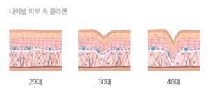 피부콜라겐