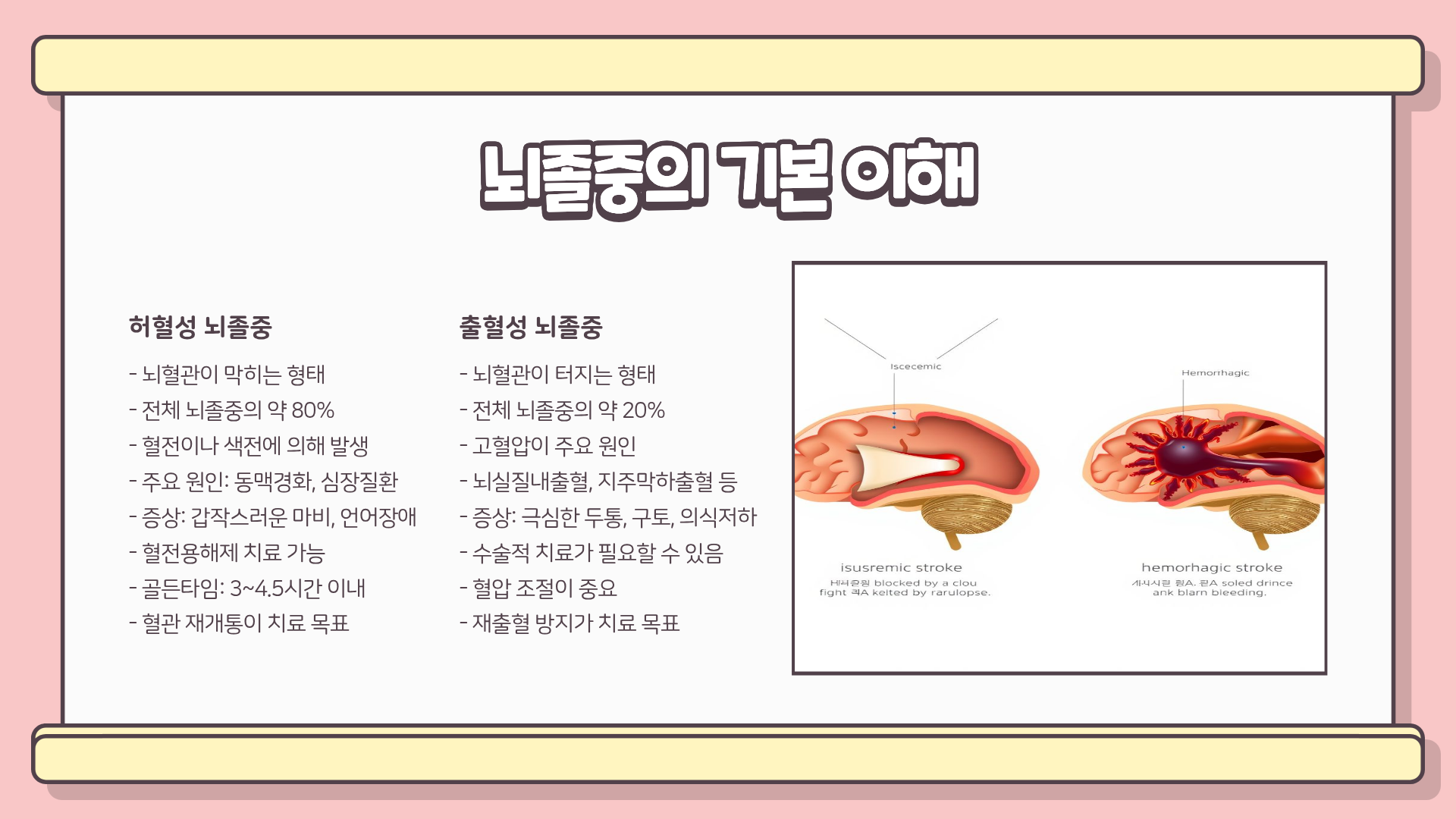 뇌졸중 전조증상 ❘ 뇌졸중 예방법 ❘ 뇌졸중 검사방법 완벽정리, 놓치면 돌이킬 수 없다