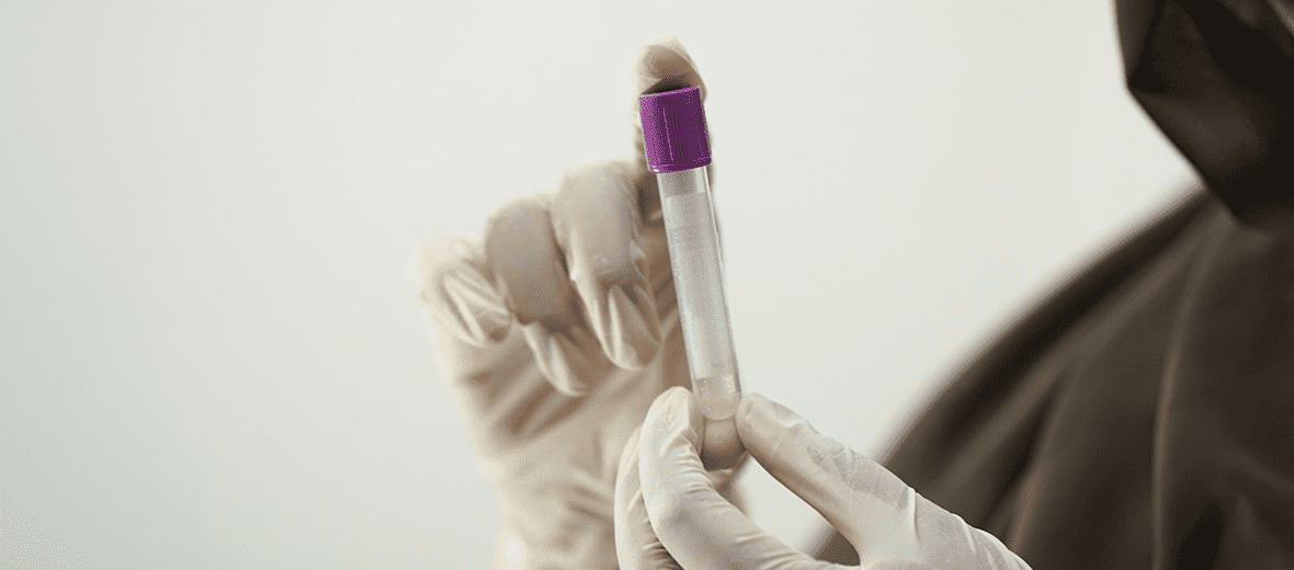 협산 효능과 관련 된 사진 - 4