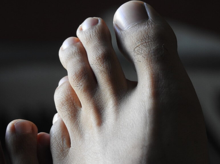 쉬고 있는 발의 모습