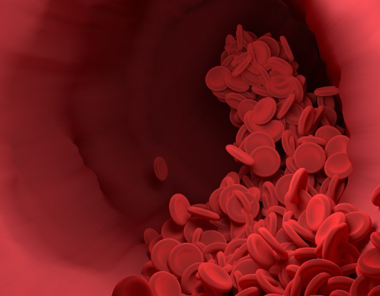 고지혈증에 좋은 음식과 고지혈증 약 총정리