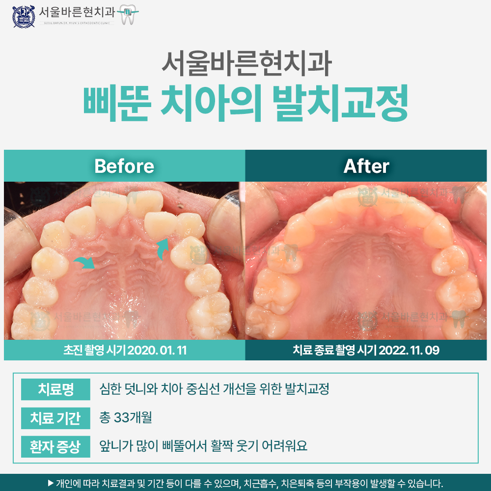 부산교정치과