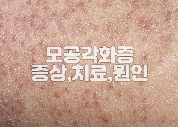 모공각화증 이미지