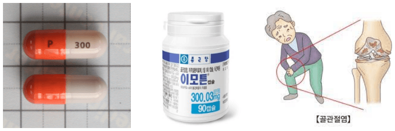 이모튼캡슐, 무릎 관절염 사진