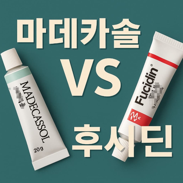 마데카솔 vs 후시딘 비교! 어떤 연고가 내 상처에 적합할까?