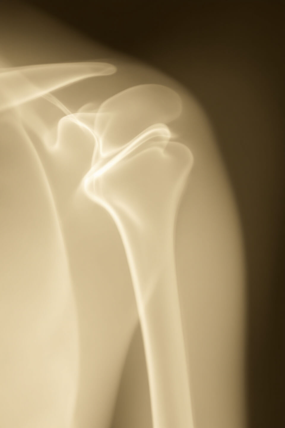 어깨통증과 관련된 사진입니다.