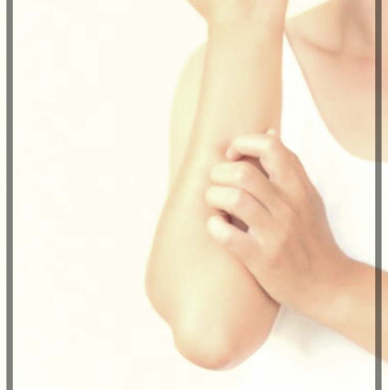 피부 기묘증 치료를 위한 실질적인 팁