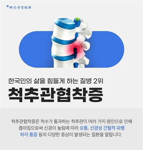 척추 협착증 원인