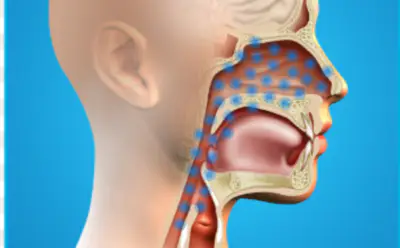 폐렴구균-예방접종-무료-대상-병원-찾기-순서-건강