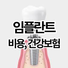 임플란트보험적용