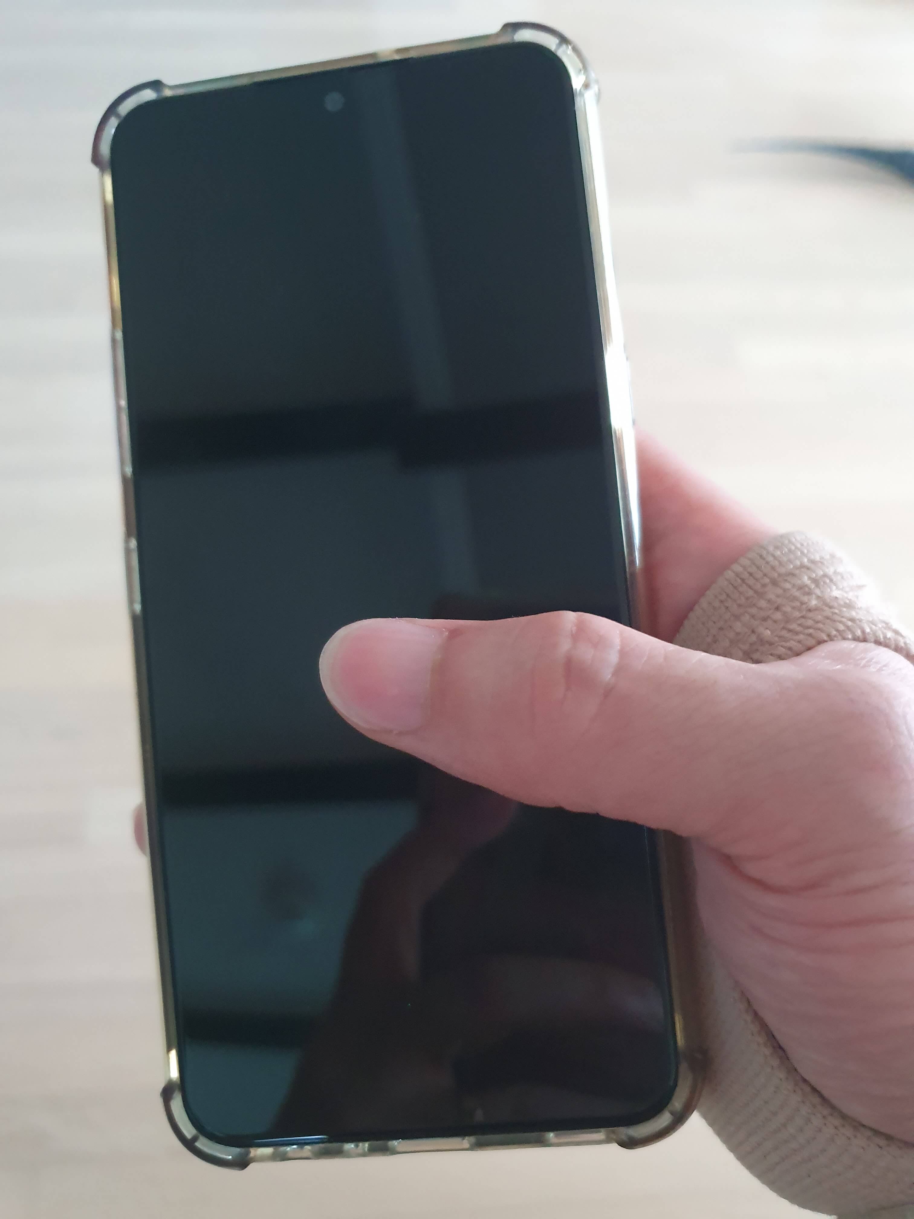 손등-통증-원인-휴대폰