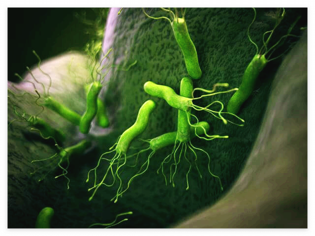 헬리코박터균 치료방법