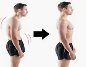 거북목-교정운동-거북목-증상-건강