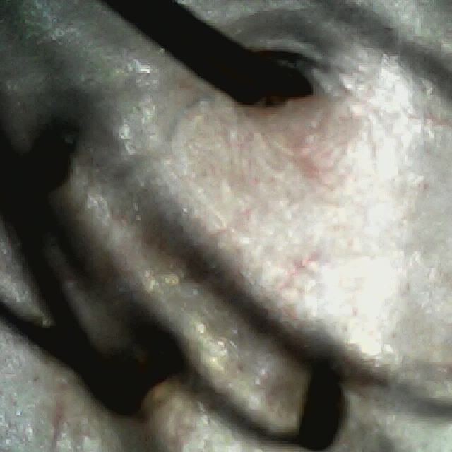 탈모 극복 프로젝트 - 뒷머리 두피 모습이다.