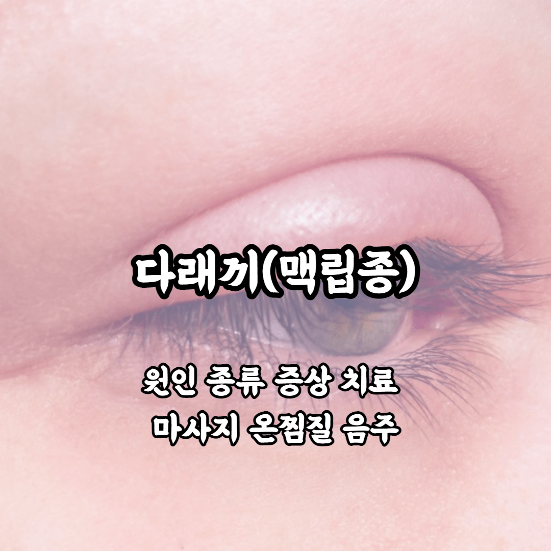 다래끼 원인 종류 초기증상 증상 치료 병원 빨리 낫는법 자연치유 마사지 온찜질 음주