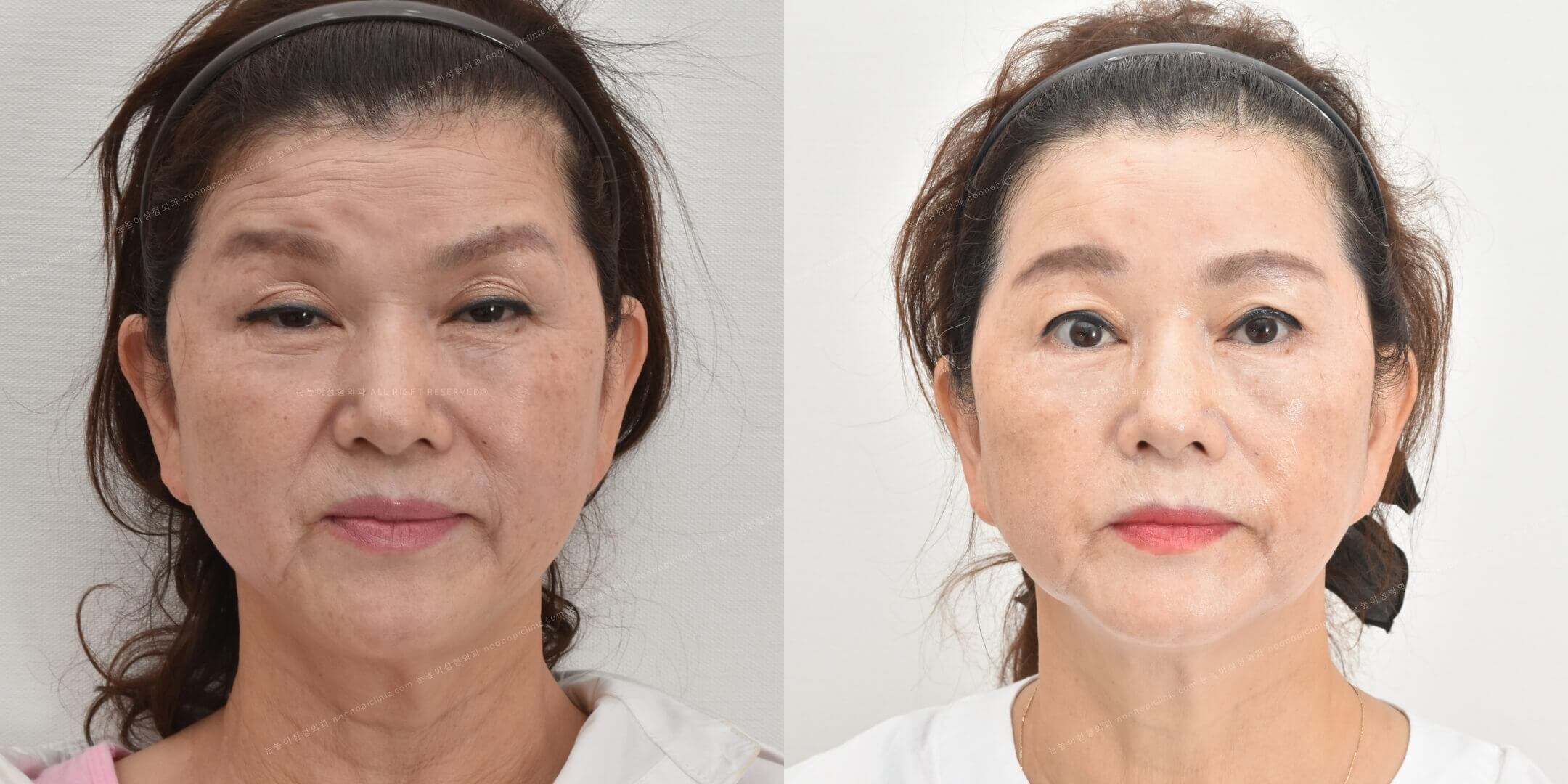 이마거상전후