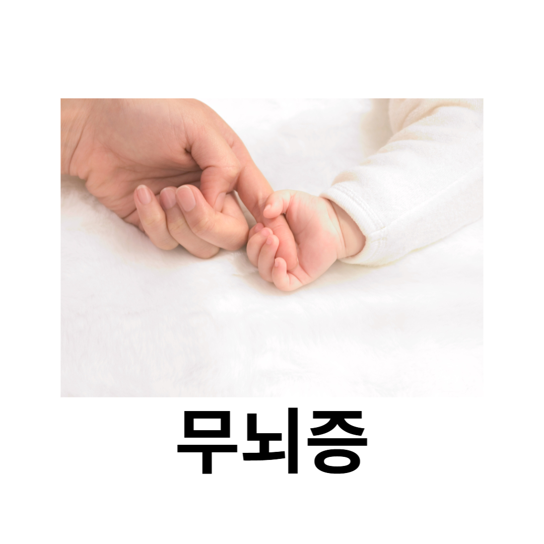 무뇌증과 관련된 사진입니다.