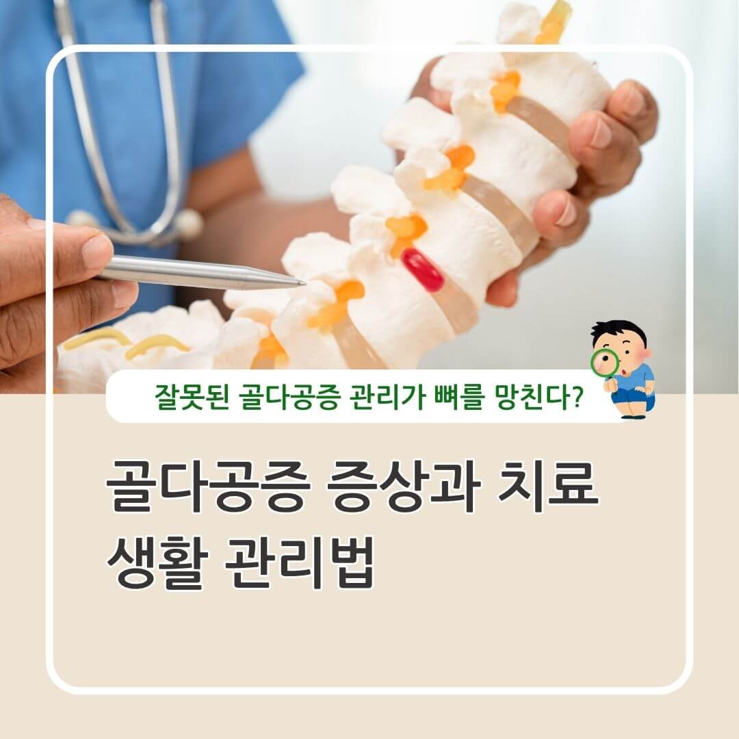 골다공증 증상과 관리
