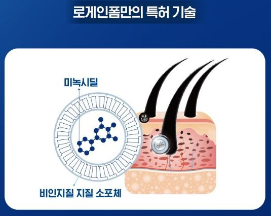 로게인폼 후기