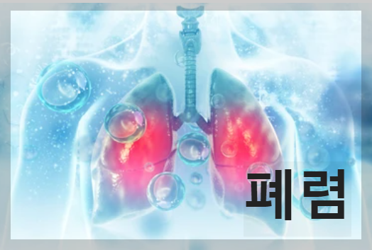 폐렴 증상 및 원인/폐렴 치료
