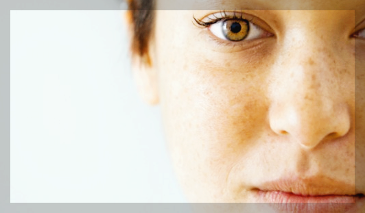 검버섯 원인 없애는 방법 경험담 제대로 공유