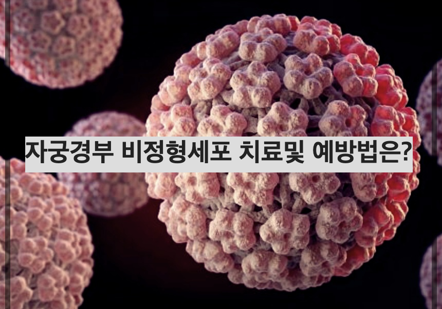 자궁경부 비정형세포 치료및 예방법은?