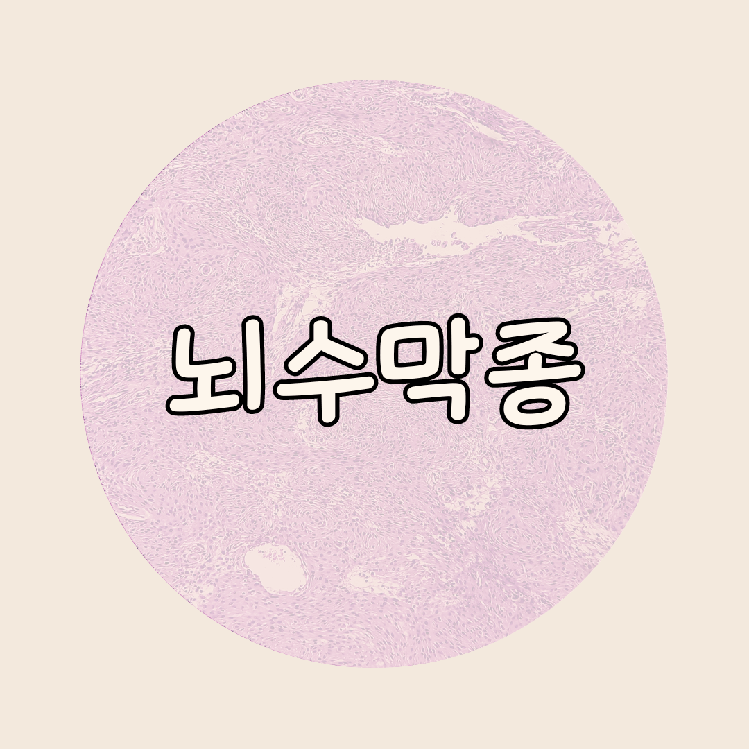 뇌수막종