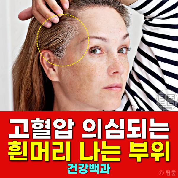 흰머리 나는 부위 고혈압 흰머리 부위별 원인