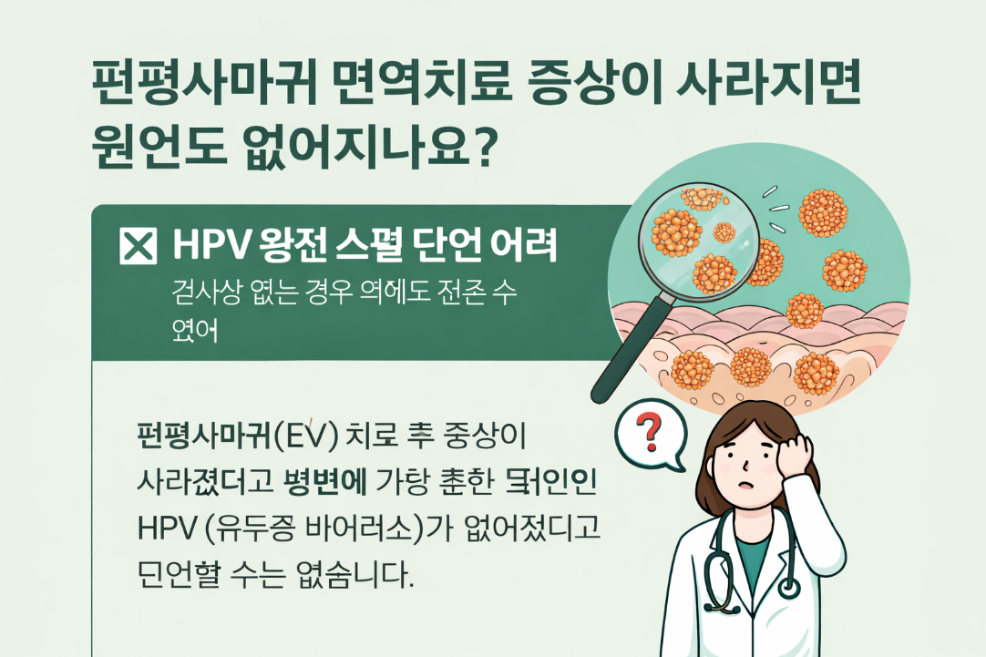 편평사마귀 면역치료, 증상만 없애면 재발 안 하나요?