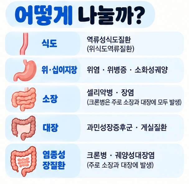 역류성식도질환 위염 소화성궤양 셀리악병 과민성장증후군 염증성장질환을 소화관 부위별로 정리한 이미지