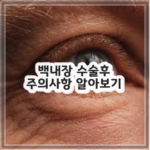 백내장 수술후 주의사항 알아보기