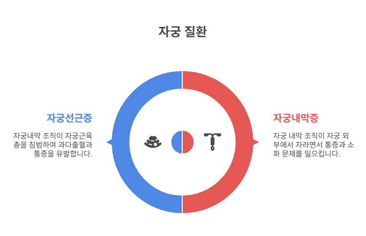자궁내막증, 자궁선근증 등 의심해야 할 질환들