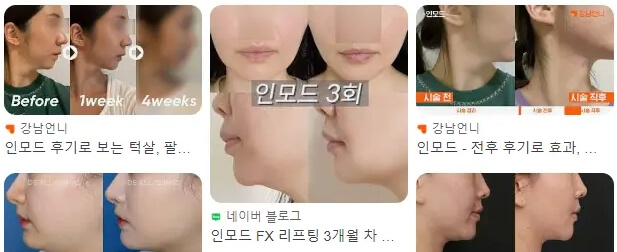 인모드