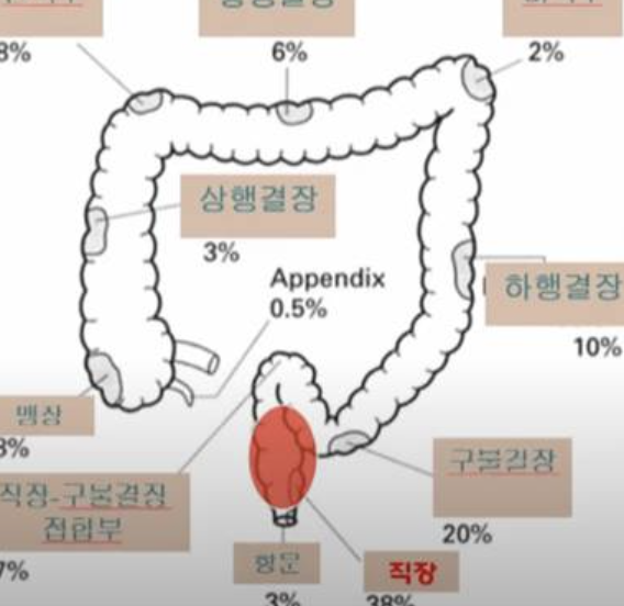 직장암 증상 2