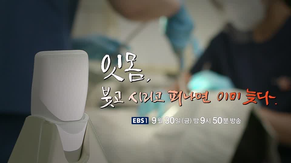 명의 붓고, 시리고, 피나면 이미 늦는 치주염 잇몸 질환 치주질환 치료, 예방 방법