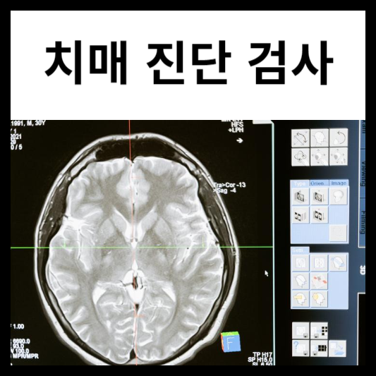 치매 진단 검사