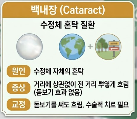 백내장 증상