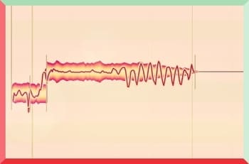 비브라토(Vibrato): 비브라토 방법, 비브라토와 트레몰로의 차이, 비브라토와 바이브레이션, Pitch Vibrato