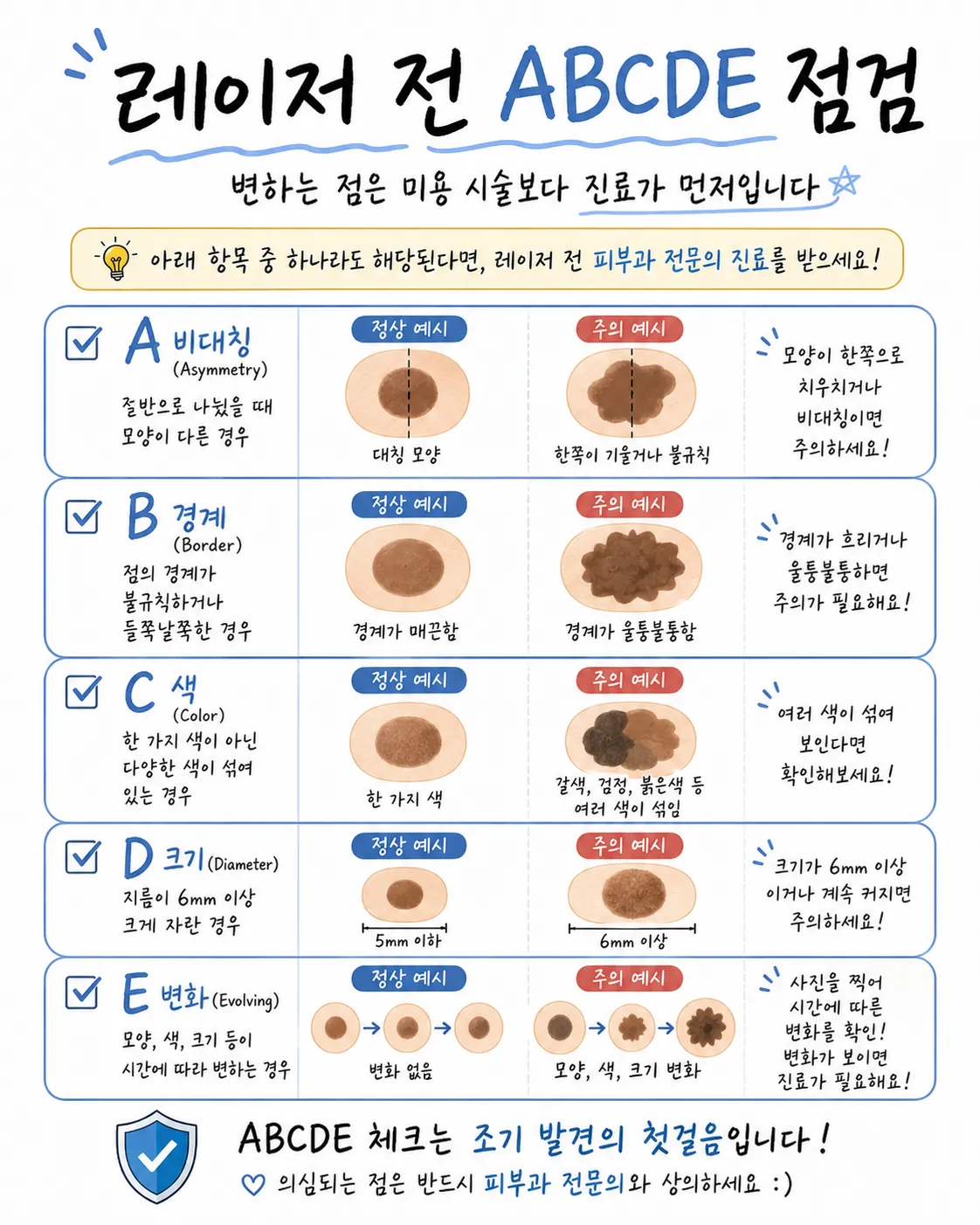 레이저 상담 전 준비